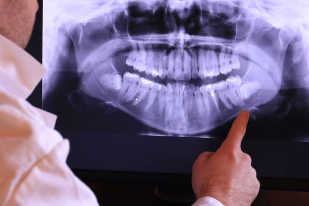 Best Walk-In Emergency Dental Services in North Lynnwood, WA