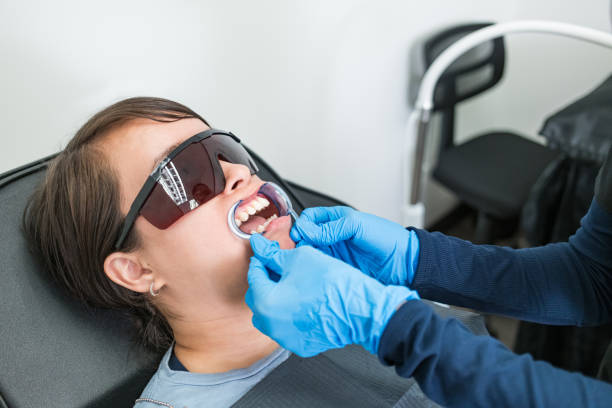 Best Emergency Wisdom Tooth Extraction in North Lynnwood, WA