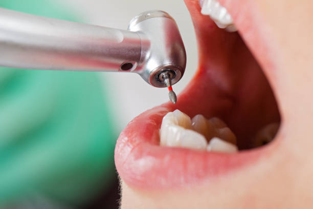 Best Emergency Treatment for Oral Infections in North Lynnwood, WA